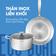 Bộ nồi chảo inox KALITE ECO Dual, inox 304, 3 lớp bắt từ tốt - Ảnh 2